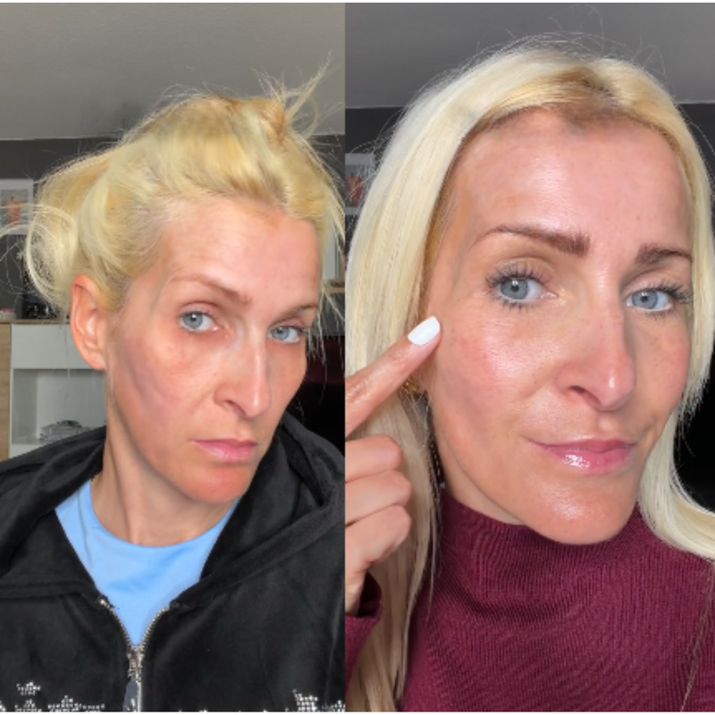 Vorher–Nachher-Ergebnis