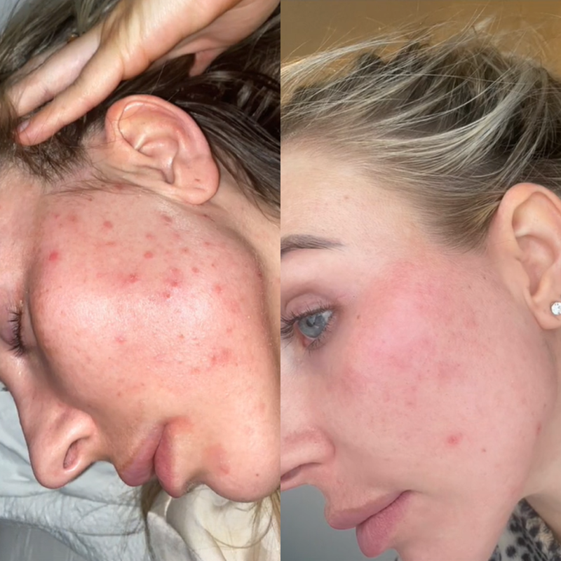 Vorher–Nachher-Ergebnis