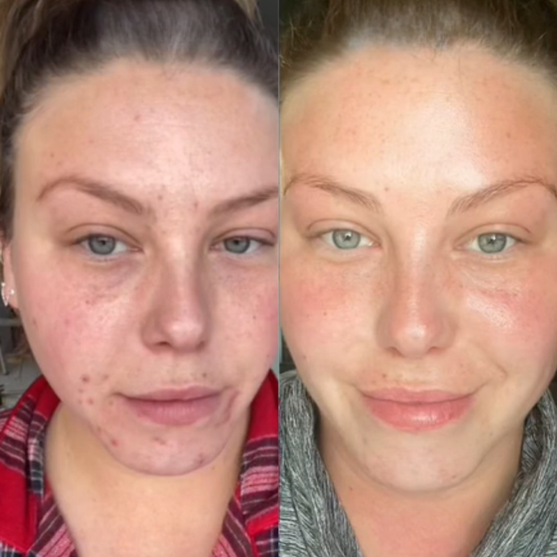 Vorher–Nachher-Ergebnis