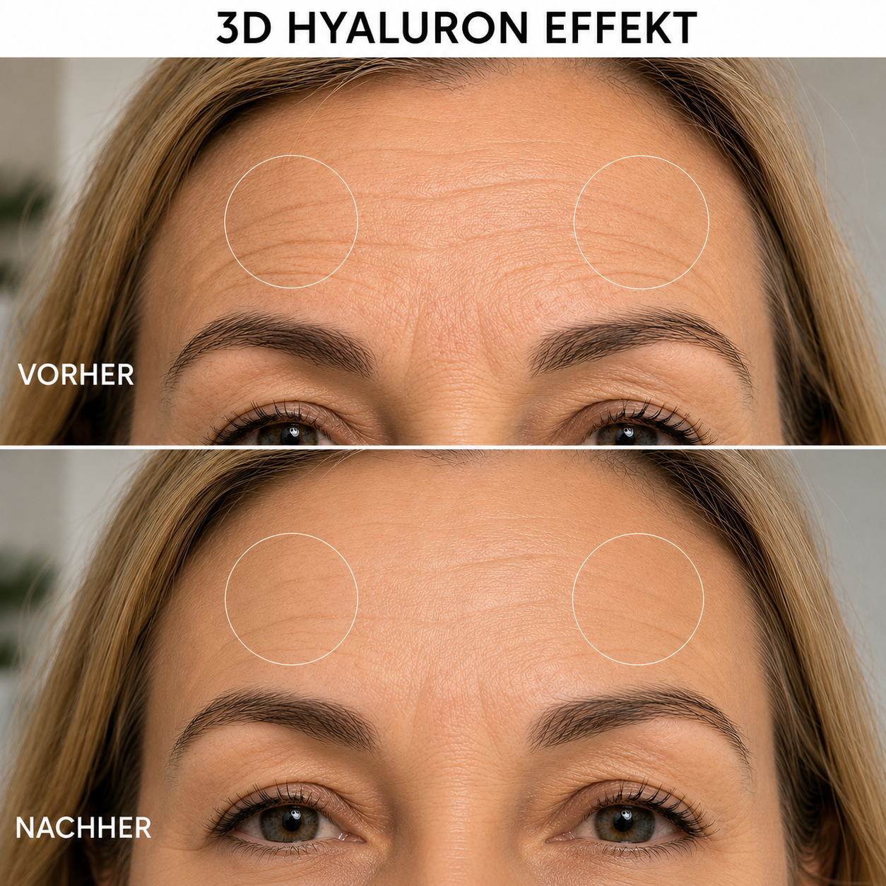 3D Hyaluron NutriSkin