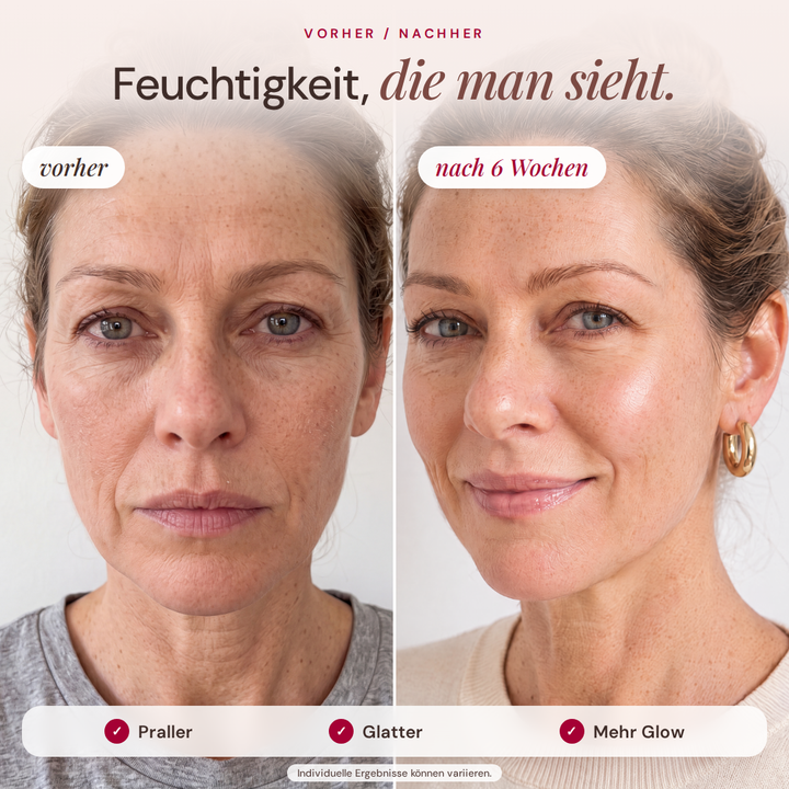 3D Hyaluron NutriSkin