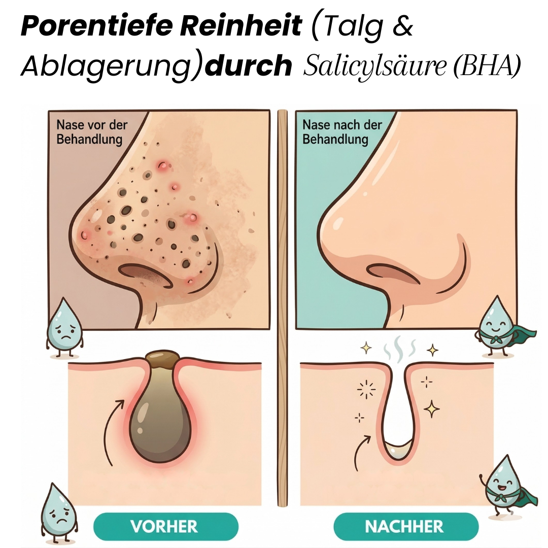 Liquid Peeling (2% BHA) Salicylsäure