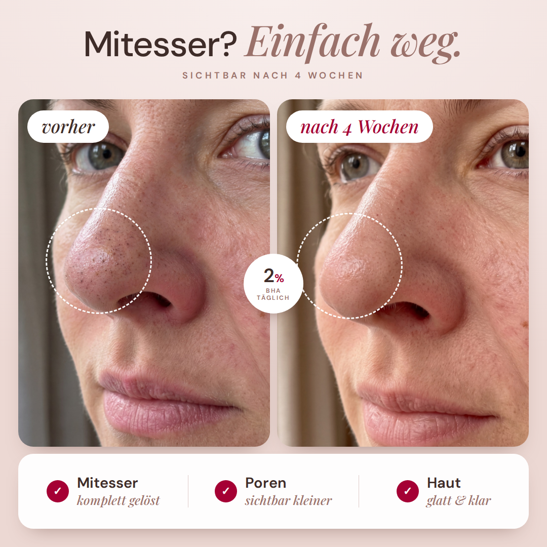 Liquid Peeling (2% BHA) Salicylsäure