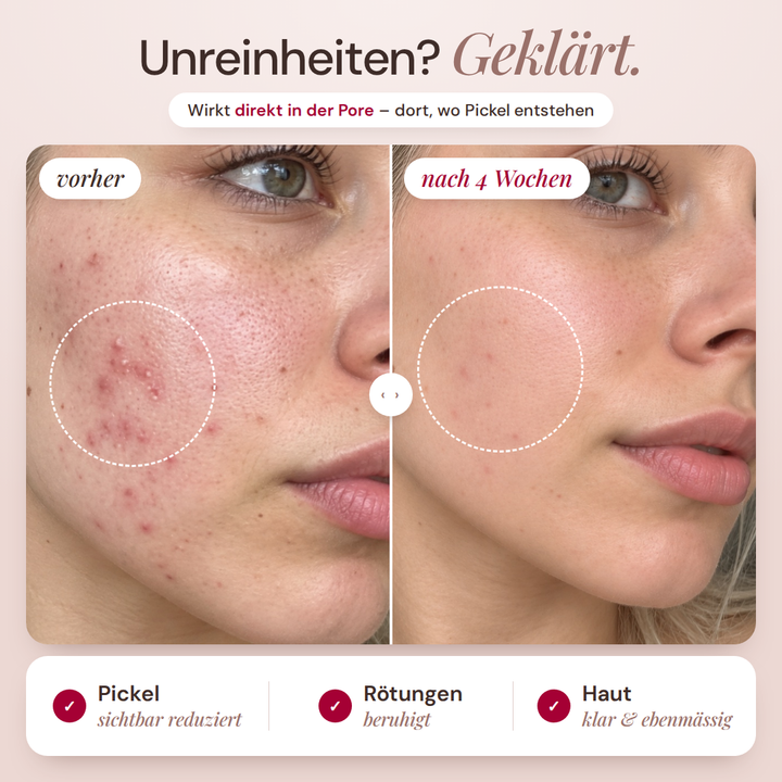 Liquid Peeling (2% BHA) Salicylsäure